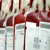 Việc chế tạo thành công máu nhân tạo sẽ giúp giảm căng thẳng về nguồn cung cấp máu. (Nguồn: Internet)