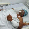 “Hiệp sĩ” bắt cướp, Nguyễn Tăng Tiên đang bị thương nặng. (Ảnh: Chí Tưởng/Vietnam+)