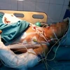 Bé Bích sau khi được đưa vào bệnh viện Việt Đức. (Nguồn: Người Lao động)