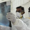 Nhân viên y tế xem hồ sơ điều trị cho một bệnh nhân nhiễm virus cúm. (AFP/TTXVN)