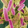 Khuẩn đường ruột Escherichia coli. 