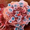 Phát hiện cách thức tiêu diệt cấu trúc tế bào ung thư