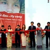 Khai mạc cuộc trưng bày đầu tiên về HIV/AIDS tại Việt Nam. (Ảnh: Dương Ngọc/TTXVN)
