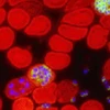 Các tế bào máu màu đỏ bị nhiễm ký sinh trùng gây bệnh sốt rét. (Nguồn: Internet)