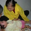 Một bé 2 tuổi rưỡi đang được châm cứu chữa bệnh bại não. (Nguồn: vnexpress.net).