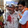 Nhân viên cứu hộ đưa nạn nhân trong một vụ đánh bom ở Pakistan rời khỏi hiện trường. (Nguồn: EPA)