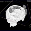 Ảnh scan não bộ xương đầu có niên đại 2.500 năm. (Nguồn: Internet)