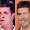 Simon Cowell. (Nguồn: dailymail