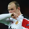 Rooney khổ sở với căn bệnh hói đầu. (Nguồn: Getty)