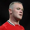 Rooney trông "ngầu" hơn sau khi chữa hói. (Nguồn: Getty)