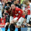 Chấn thương khá nghiêm trọng của Rooney. (Nguồn: EPA)