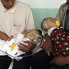 Trẻ em Trung Quốc bị ngộ độc do dùng sữa nhiễm melamin. (Ảnh: Internet)