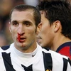 Dù phải đổ máu, Juventus cũng không tránh khỏi thất bại trước Cagliari. (Ảnh: Reuters)