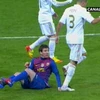 Hành động dẫm lên tay Messi của Pepe. (Nguồn: Getty Images)