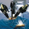 Robot da Vinci đang trợ giúp các bác sĩ trong một ca phẫu thuật thoát vị đĩa đệm. (Nguồn: Internet)