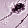 Một nhánh nấm Aspergillus được cho là thủ phạm của đợt bùng phát viêm màng não. (Nguồn: CDC)