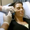 Botox thường được biết đến với tác dụng chống nếp nhăn. (Ảnh: dailymail.co.uk)