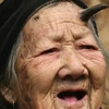 Cụ bà Zhang Ruifang tại quê nhà với chiếc sừng trên trán. (Ảnh: THX)