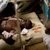 Nạn nhân vụ đánh bom hôm 11/7 tại bệnh viện Mulago ở Kampala. (Nguồn: AFP/TXVN)