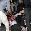 Chuyển các nạn nhân trong vụ đánh bom ở Zahedan. (Nguồn: AFP/TTXVN)
