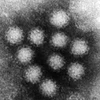 Siêu vi khuẩn norovirus. (Nguồn: Internet)