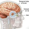 Hình ảnh não người. (Nguồn: Internet)