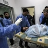 Một chiến binh lực lượng nổi dậy bị thương trong cuộc xung đột được chuyển đến bệnh viện ở Ajdabiya. (Nguồn: AFP/TTXVN)