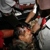Thiếu tướng Khattiya Sawasdipol bị bắn trọng thương. (Nguồn: Reuters)