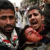 Các vụ đụng độ tại Yemen đã khiến ít nhất 30 người thiệt mạng và khoảng 200 người bị thương. (Nguồn: Getty Images)
