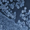 Hình ảnh virus H7N9. (Nguồn: medicalxpress.com)