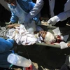 Người bị thương trong một cuộc giao tranh tại Yemen (Nguồn: Reuters)