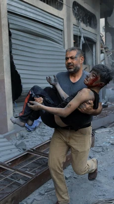Chuyển cậu bé bị thương sau đợt không kích của Israel xuống thành phố Khan Younis, Dải Gaza ngày 19/10/2023. (Ảnh: THX/TTXVN)