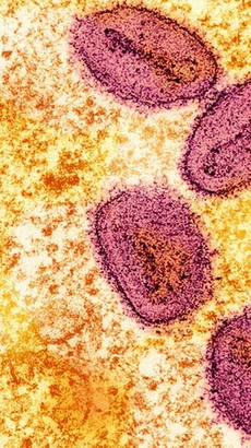 Virus đậu mùa khỉ. (Ảnh: Reuters)