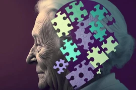 Bệnh Alzheimer có thể được phát hiện sớm bằng những câu hỏi đơn giản. (Nguồn: biospectrumasia)