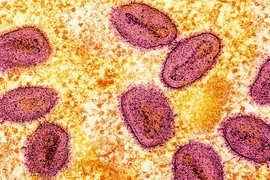 Virus đậu mùa khỉ. (Ảnh: Reuters)