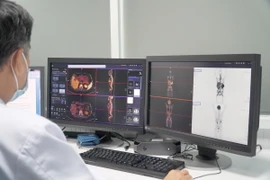 Hình ảnh chụp PET/CT của bệnh nhân tại Bệnh viện Chợ Rẫy Thành phố Hồ Chí Minh. (Ảnh: TTXVN phát)