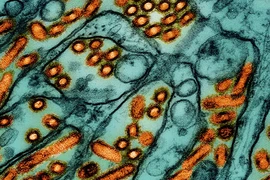Các hạt virus cúm gia cầm H5N1 (màu cam) dưới kính hiển vi. (Nguồn: Statnews)
