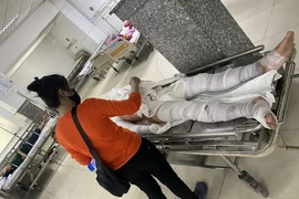 Các công nhân bị bỏng cấp cứu tại Bệnh viện đa khoa tỉnh. (Ảnh: Chí Tưởng/TTXVN)