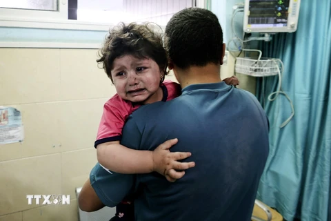 Một em bé Palestine bị thương chờ được điều trị tại bệnh viện al-Shifa, sau cuộc oanh tạc của máy bay Israel xuống Dải Gaza. (Ảnh: AFP/TTXVN)