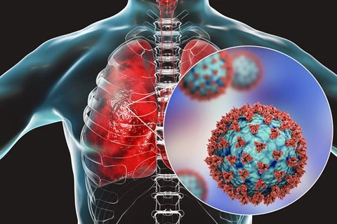 Virus SARS-CoV-2 tấn công khiến phổi bị suy giảm chức năng hô hấp. (Ảnh: Science Photo) 