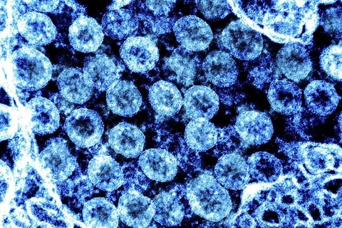 Virus SARS-CoV-2 trong mẫu bệnh phẩm của bệnh nhân mắc COVID-19. (Ảnh: AFP/TTXVN)