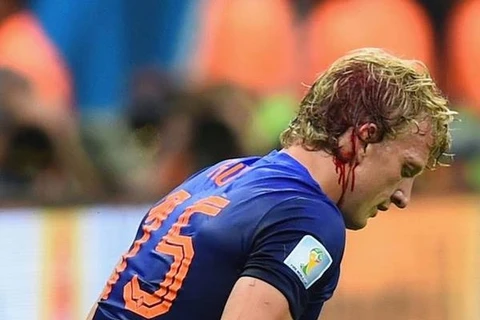 Dirk Kuyt chảy máu ròng ròng vẫn chiến với Brazil tới cuối trận