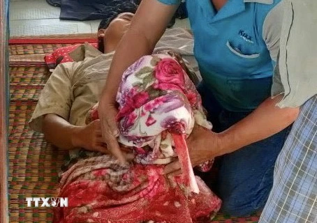 Nạn nhân được xác định là anh Huỳnh Văn Chí, 45 tuổi, quê ở huyện Ba Tri, tỉnh Bến Tre, bị tai nạn khi đang làm việc trên tàu cá mang số hiệu BT 98146. (Ảnh: TTXVN phát)