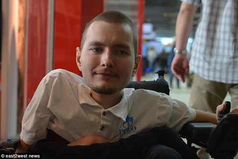 Valery Spiridonov tình nguyện tham gia ca ghép đầu người đầu tiên trên thế giới. (Ảnh: dailymail.co.uk)