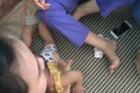 Hình ảnh em bé bị trói chân, tay do người mẹ cung cấp gây chấn động dư luận.