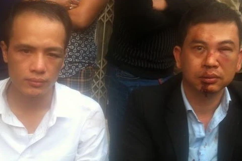 Hà Nội: Khởi tố điều tra vụ 2 luật sư bị hành hung tại Chương Mỹ
