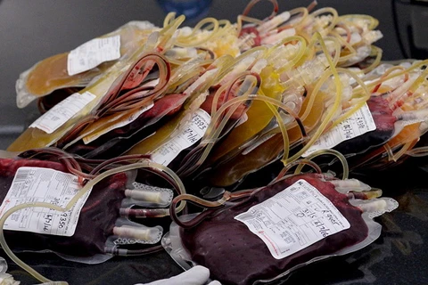 2.234 người bị nhiễm HIV sau khi được truyền máu. (Nguồn: AFP/Getty Images)