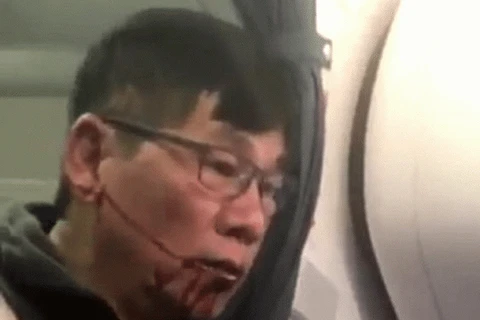 Hình ảnh ông David Dao chảy máu miệng sau khi bị kéo lê trên sàn máy bay.