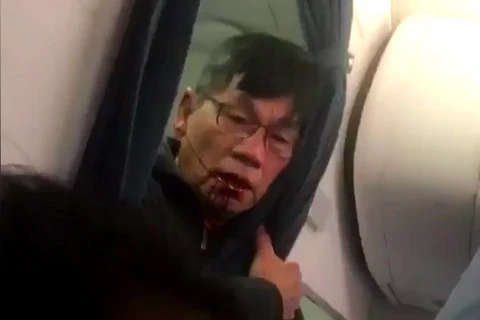 Hình ảnh bác sỹ gốc Việt trước khi phải rời máy bay., (Nguồn: gizmodo.com)