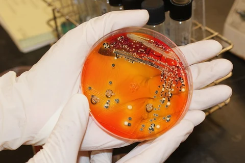 Hàng trăm người nhiễm vi khuẩn salmonella tại Australia
